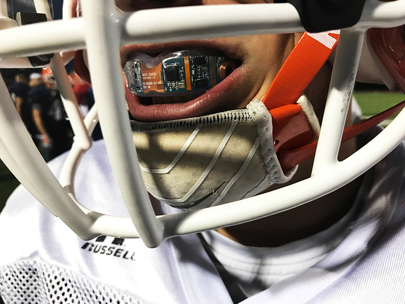 This Smart Mouthguard Can Monitor Concussions
