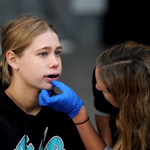 DUNEDIN, NEW ZEALAND - MAY 29: A Prevent Biometrics mouthguard is fitted during the Women's Rugby Day Head Impact Study Programme at Forsyth Barr Stadium on May 29, 2021 in Dunedin, New Zealand. (Photo by Joe Allison/World Rugby via Getty Images)